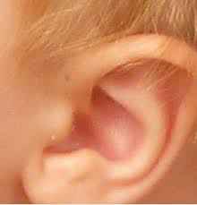 ear-hole