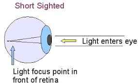 short-sighted